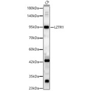 Western blot analysis of lysates from C6 cells, using LZTR1 Antibody at 1/2000 dilution. Secondary antibody: HRP-conjugated Goat anti-Rabbit IgG (H+L) at 1/10000 dilution. Lysates/proteins: 25 µg per lane. Blocking buffer: 3% nonfat dry milk in TBST. Exposure time: 60s.