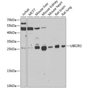 Western blot analysis of various lysates using UBE2R2 Antibody at 1/1000 dilution. Secondary antibody: HRP-conjugated Goat anti-Rabbit IgG (H+L) at 1/10000 dilution. Lysates/proteins: 25 µg per lane. Blocking buffer: 3% nonfat dry milk in TBST. Exposure time: 30s.