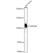 Western blot analysis of various lysates, using CSRP2BP Antibody at 1/2000 dilution. Secondary antibody: HRP-conjugated Goat anti-Rabbit IgG (H+L) at 1/10000 dilution. Lysates/proteins: 25 µg per lane. Blocking buffer: 3% nonfat dry milk in TBST. Exposure time: 30s.
