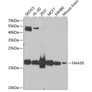 Western blot analysis of various lysates using NAA50 Antibody at 1/1000 dilution. Secondary antibody: HRP-conjugated Goat anti-Rabbit IgG (H+L) at 1/10000 dilution. Lysates/proteins: 25 µg per lane. Blocking buffer: 3% nonfat dry milk in TBST. Exposure time: 90s.