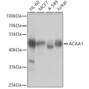 abx006941