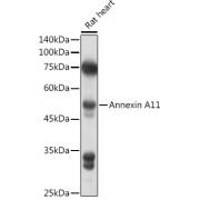 Western blot analysis of lysates from Rat heart , using Annexin A11 Antibody at 1/1000 dilution. Secondary antibody: HRP-conjugated Goat anti-Rabbit IgG (H+L) at 1/10000 dilution. Lysates/proteins: 25 µg per lane. Blocking buffer: 3% nonfat dry milk in TBST. Exposure time: 60s.