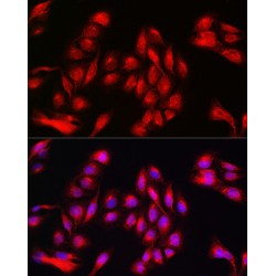 Annexin A11 (ANXA11) Antibody