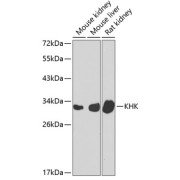 Western blot analysis of various lysates using KHK Antibody at 1/1000 dilution. Secondary antibody: HRP-conjugated Goat anti-Rabbit IgG (H+L) at 1/10000 dilution. Lysates/proteins: 25 µg per lane. Blocking buffer: 3% nonfat dry milk in TBST. Exposure time: 90s.