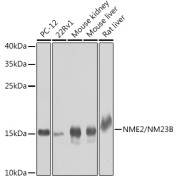 Western blot analysis of various lysates using NME2/NM23B Antibody at 1/1000 dilution. Secondary antibody: HRP-conjugated Goat anti-Rabbit IgG (H+L) at 1/10000 dilution. Lysates/proteins: 25 µg per lane. Blocking buffer: 3% nonfat dry milk in TBST. Exposure time: 30s.