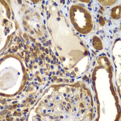 Nucleoside Diphosphate Kinase B (NME2) Antibody