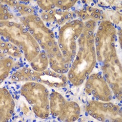 Nucleoside Diphosphate Kinase B (NME2) Antibody