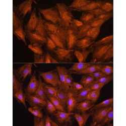 Disheveled Associated Activator of Morphogenesis 2 (DAAM2) Antibody
