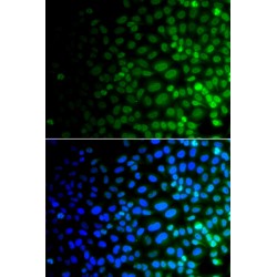 Serine/threonine-Protein Kinase ULK4 (ULK4) Antibody