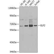 Western blot analysis of various lysates using ELF2 Antibody at 1/1000 dilution. Secondary antibody: HRP-conjugated Goat anti-Rabbit IgG (H+L) at 1/10000 dilution. Lysates/proteins: 25 µg per lane. Blocking buffer: 3% nonfat dry milk in TBST. Exposure time: 1s.