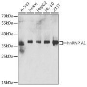 Western blot analysis of various lysates using hnRNP A1 Antibody at 1/1000 dilution. Secondary antibody: HRP-conjugated Goat anti-Rabbit IgG (H+L) at 1/10000 dilution. Lysates/proteins: 25 µg per lane. Blocking buffer: 3% nonfat dry milk in TBST. Exposure time: 30s.