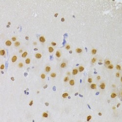 Heterogeneous Nuclear Ribonucleoprotein A1 (HNRNPA1) Antibody