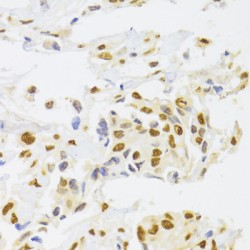 Heterogeneous Nuclear Ribonucleoprotein A1 (HNRNPA1) Antibody