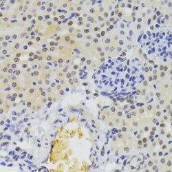 Heterogeneous Nuclear Ribonucleoprotein A1 (HNRNPA1) Antibody