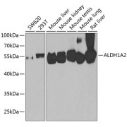 Western blot analysis of various lysates using ALDH1A2 Antibody at 1/1000 dilution. Secondary antibody: HRP-conjugated Goat anti-Rabbit IgG (H+L) at 1/10000 dilution. Lysates/proteins: 25 µg per lane. Blocking buffer: 3% nonfat dry milk in TBST. Exposure time: 90s.
