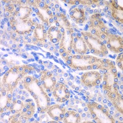 Aldehyde Dehydrogenase 1 Family Member A2 (ALDH1A2) Antibody