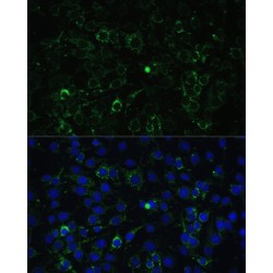 Aldehyde Dehydrogenase 1 Family Member A2 (ALDH1A2) Antibody