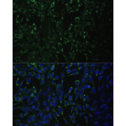 Aldehyde Dehydrogenase 1 Family Member A2 (ALDH1A2) Antibody