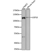 Western blot analysis of various lysates using USP10 Antibody at 1/1000 dilution. Secondary antibody: HRP-conjugated Goat anti-Rabbit IgG (H+L) at 1/10000 dilution. Lysates/proteins: 25 µg per lane. Blocking buffer: 3% nonfat dry milk in TBST. Exposure time: 90s.