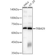 Western blot analysis of various lysates, using TRIM29 Antibody at 1/2000 dilution. Secondary antibody: HRP-conjugated Goat anti-Rabbit IgG (H+L) at 1/10000 dilution. Lysates/proteins: 25 µg per lane. Blocking buffer: 3% nonfat dry milk in TBST. Exposure time: 10s.