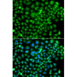 Small Ubiquitin-Related Modifier 4 (SUMO4) Antibody