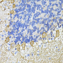 Carbonic Anhydrase-Related Protein (CA8) Antibody