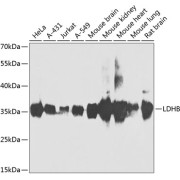Western blot analysis of various lysates using LDHB Antibody at 1/1000 dilution. Secondary antibody: HRP-conjugated Goat anti-Rabbit IgG (H+L) at 1/10000 dilution. Lysates/proteins: 25 µg per lane. Blocking buffer: 3% nonfat dry milk in TBST. Exposure time: 90s.