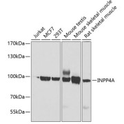Western blot analysis of various lysates using INPP4A Antibody at 1/1000 dilution. Secondary antibody: HRP-conjugated Goat anti-Rabbit IgG (H+L) at 1/10000 dilution. Lysates/proteins: 25 µg per lane. Blocking buffer: 3% nonfat dry milk in TBST. Exposure time: 30s.