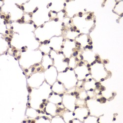 Serine/threonine-Protein Kinase VRK1 (VRK1) Antibody