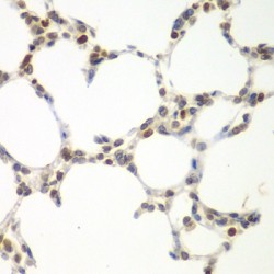Serine/threonine-Protein Kinase VRK1 (VRK1) Antibody
