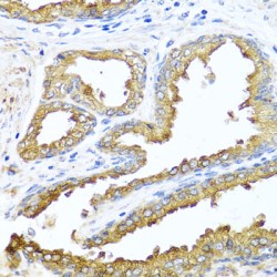 NCK Adaptor Protein 2 (NCK2) Antibody