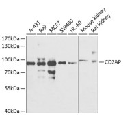 Western blot analysis of various lysates using CD2AP Antibody at 1/500 dilution. Secondary antibody: HRP-conjugated Goat anti-Rabbit IgG (H+L) at 1/10000 dilution. Lysates/proteins: 25 µg per lane. Blocking buffer: 3% nonfat dry milk in TBST. Exposure time: 60s.