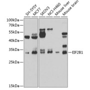 Western blot analysis of various lysates using EIF2B1 Antibody at 1/1000 dilution. Secondary antibody: HRP-conjugated Goat anti-Rabbit IgG (H+L) at 1/10000 dilution. Lysates/proteins: 25 µg per lane. Blocking buffer: 3% nonfat dry milk in TBST. Exposure time: 90s.