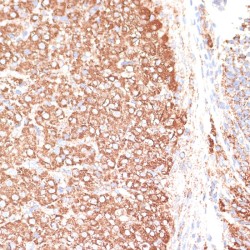 Potassium Voltage-Gated Channel Subfamily S Member 3 (KCNS3) Antibody