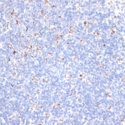 Potassium Voltage-Gated Channel Subfamily S Member 3 (KCNS3) Antibody