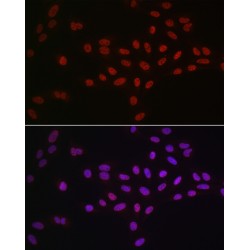 ATP-Dependent RNA Helicase DDX39A (DDX39A) Antibody