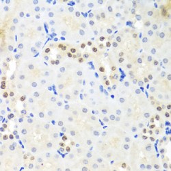 ATP-Dependent RNA Helicase DDX39A (DDX39A) Antibody