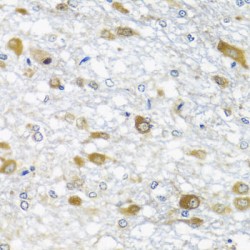 ATP-Dependent RNA Helicase DDX39A (DDX39A) Antibody