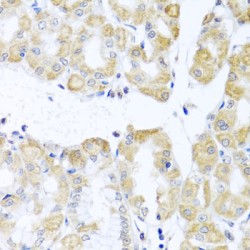ATP-Dependent RNA Helicase DDX39A (DDX39A) Antibody