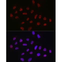 ATP-Dependent RNA Helicase DDX39A (DDX39A) Antibody