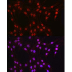 ATP-Dependent RNA Helicase DDX39A (DDX39A) Antibody