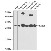 Western blot analysis of various lysates using RAB23 Antibody at 1/1000 dilution. Secondary antibody: HRP-conjugated Goat anti-Rabbit IgG (H+L) at 1/10000 dilution. Lysates/proteins: 25 µg per lane. Blocking buffer: 3% nonfat dry milk in TBST. Exposure time: 90s.