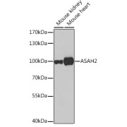 Western blot analysis of various lysates using ASAH2 Antibody at 1/500 dilution. Secondary antibody: HRP-conjugated Goat anti-Rabbit IgG (H+L) at 1/10000 dilution. Lysates/proteins: 25 µg per lane. Blocking buffer: 3% nonfat dry milk in TBST. Exposure time: 10s.
