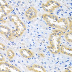 Bone Morphogenetic Protein 3 (BMP3) Antibody