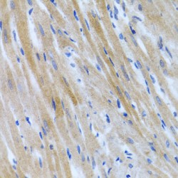 Bone Morphogenetic Protein 3 (BMP3) Antibody