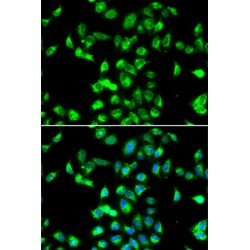 Kallistatin (SERPINA4) Antibody