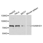 Western blot analysis of various lysates using [KO Validated] SAMHD1 Antibody at 1/1000 dilution. Secondary antibody: HRP-conjugated Goat anti-Rabbit IgG (H+L) at 1/10000 dilution. Lysates/proteins: 25 µg per lane. Blocking buffer: 3% nonfat dry milk in TBST. Exposure time: 90s.