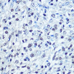 Deoxynucleoside Triphosphate Triphosphohydrolase SAMHD1 (SAMHD1) Antibody