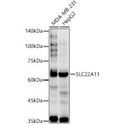 Western blot analysis of various lysates using SLC22A11 Antibody at 1/1000 dilution. Secondary antibody: HRP-conjugated Goat anti-Rabbit IgG (H+L) at 1/10000 dilution. Lysates/proteins: 25 µg per lane. Blocking buffer: 3% nonfat dry milk in TBST. Exposure time: 30s.