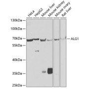 Western blot analysis of various lysates using ALG1 Antibody at 1/1000 dilution. Secondary antibody: HRP-conjugated Goat anti-Rabbit IgG (H+L) at 1/10000 dilution. Lysates/proteins: 25 µg per lane. Blocking buffer: 3% nonfat dry milk in TBST. Exposure time: 30s.